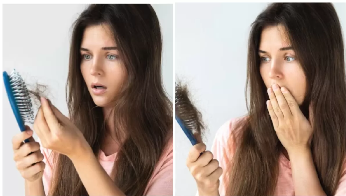 Hair Fall Problem: झड़ते बालों से हैं परेशान, करें दही का इस्तेमाल